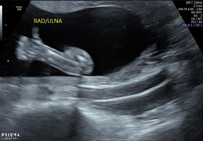 Expecting a baby soon. They let us know everything is going great!